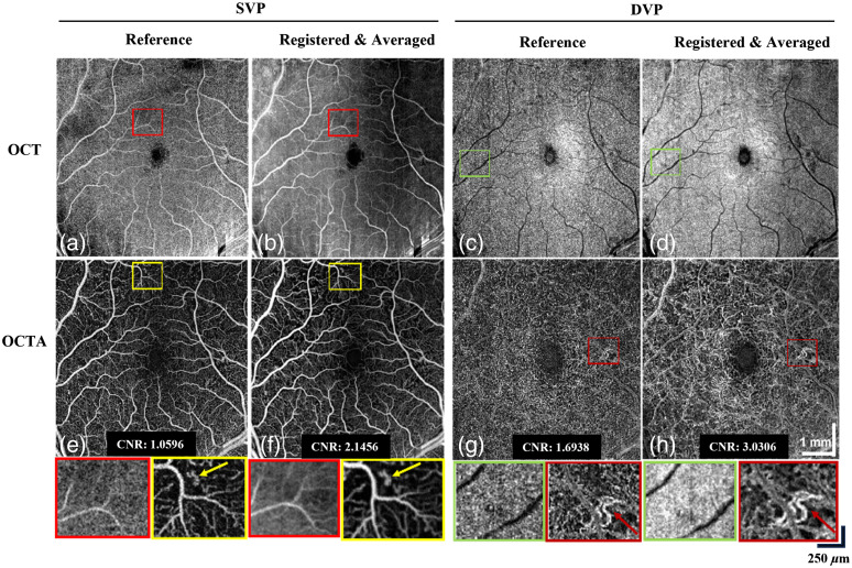 Fig. 10