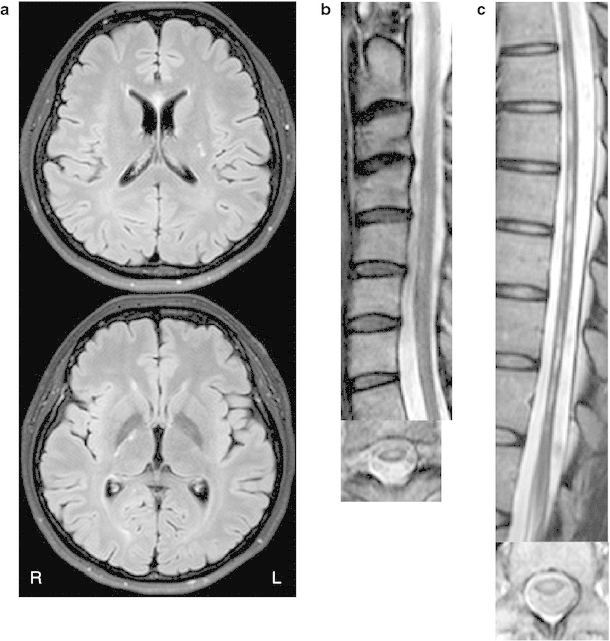 Fig. 1