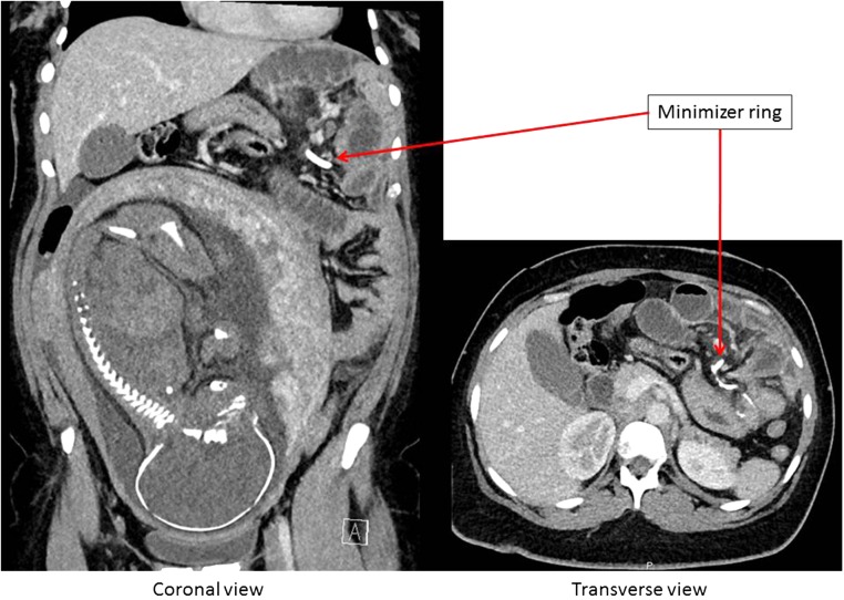 Figure 1: