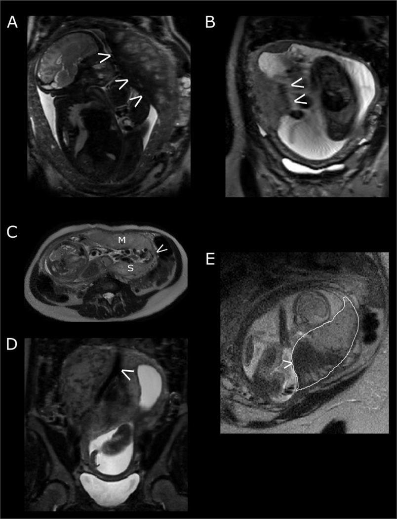 Figure 3: