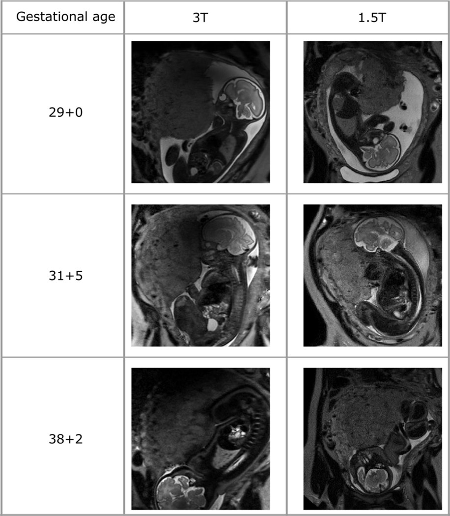 Figure 4: