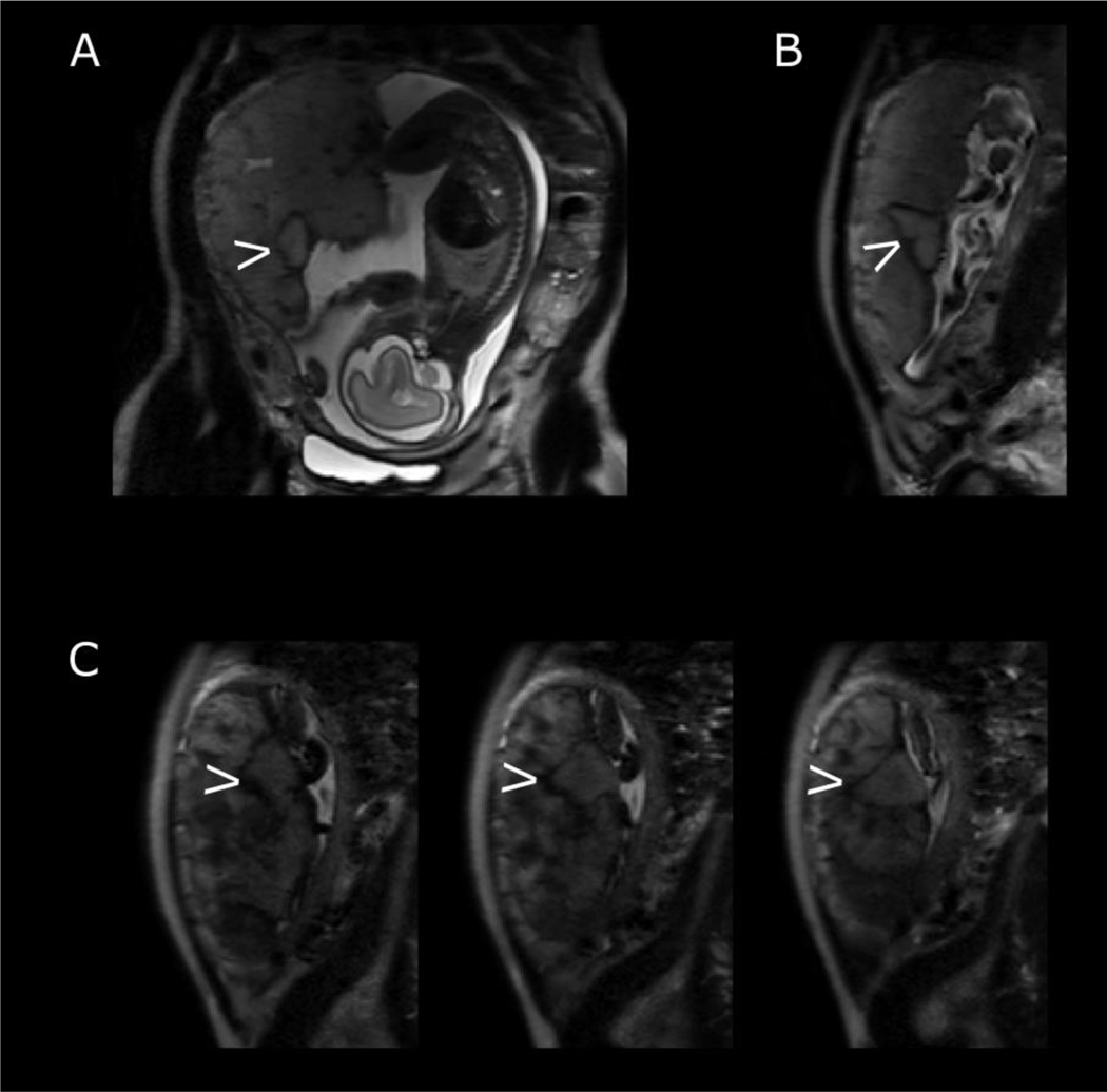 Figure 6: