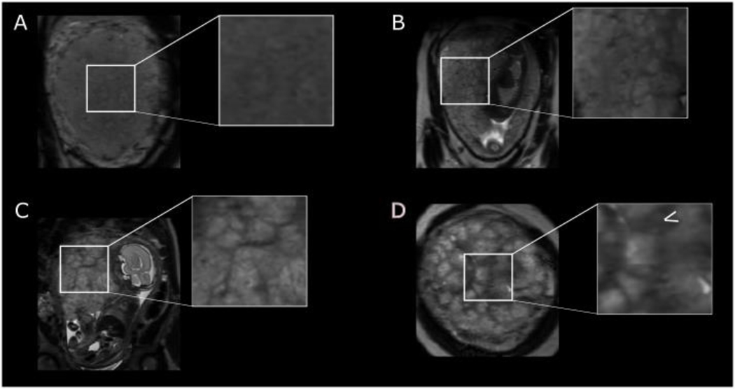 Figure 2: