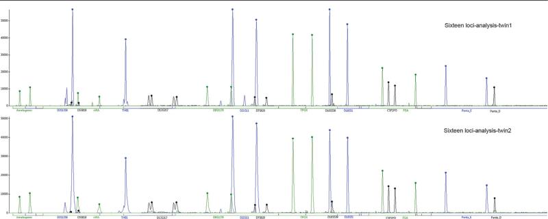 FIGURE 4