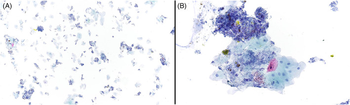 FIGURE 3