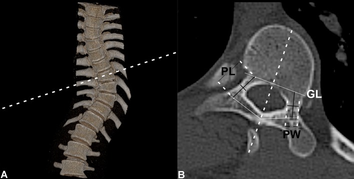 Fig. 1A–B