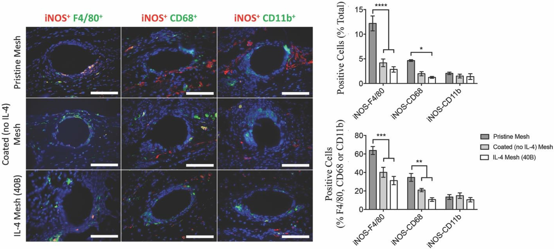 Distinct Macrophage Populations and Phenotypes Associated with IL-4 ...