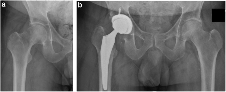 Figure 1