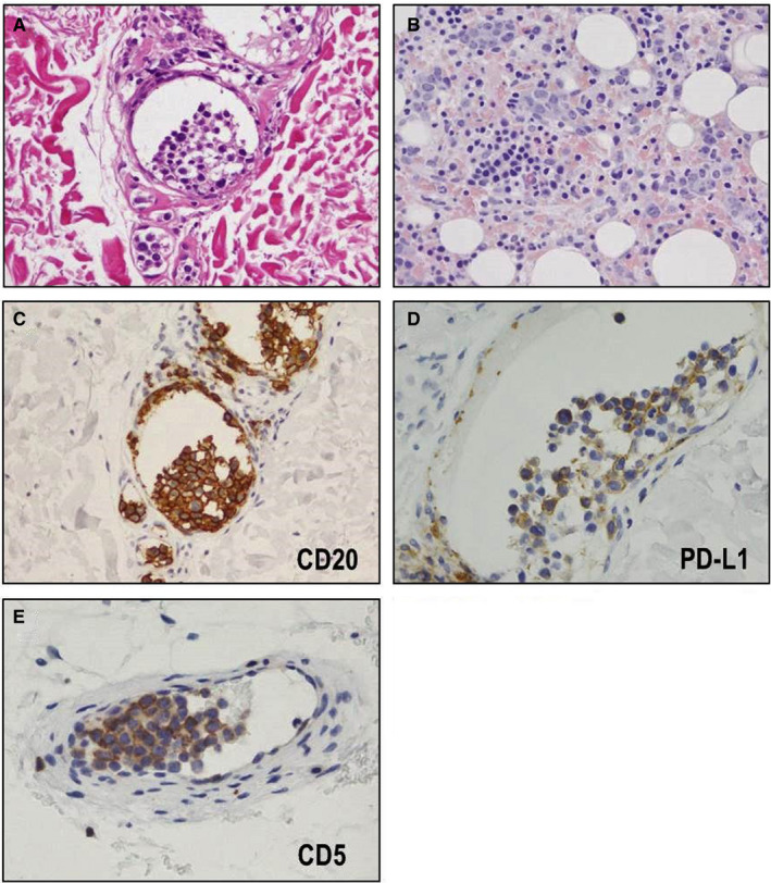 FIGURE 2