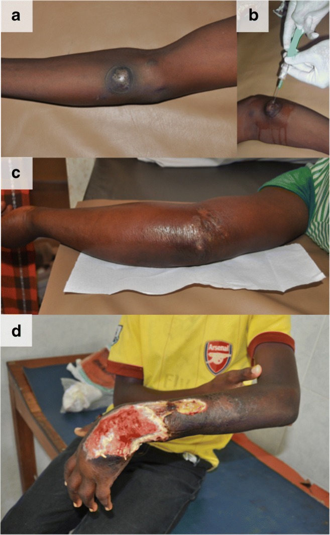 Fig. 1