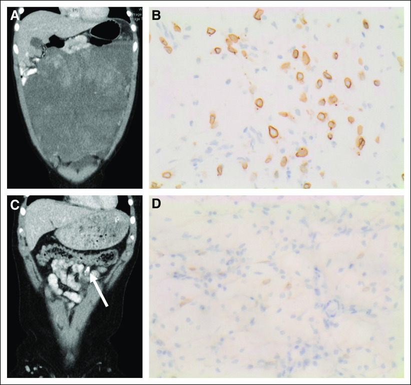 FIG 2.