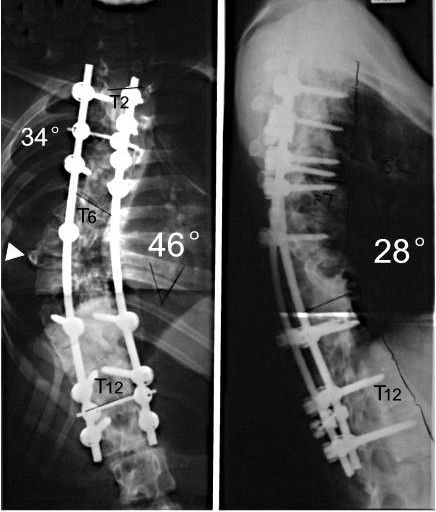 Figure 13