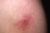 Fig. 5