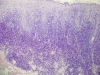Fig. 12