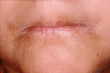 Fig. 9