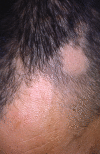 Fig. 3