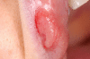 Fig. 6
