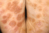 Fig. 2