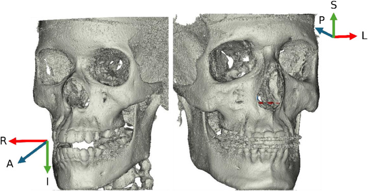 Fig 2