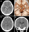 FIG. 1