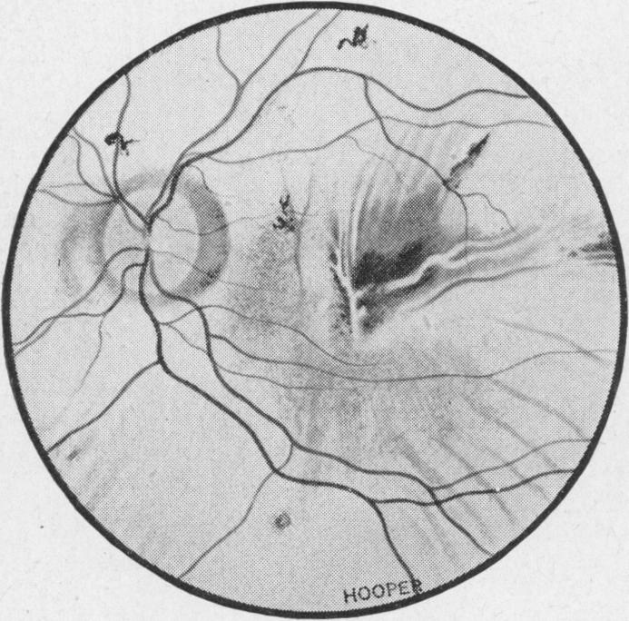 Fig. 9