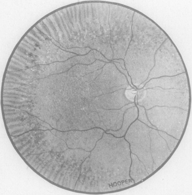 Fig. 13