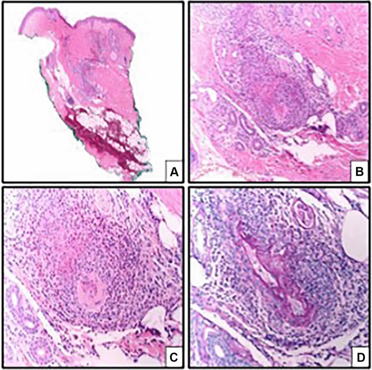 Fig. 2