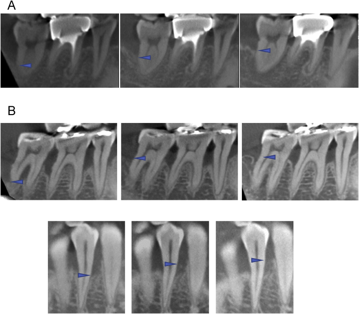 Fig. 3