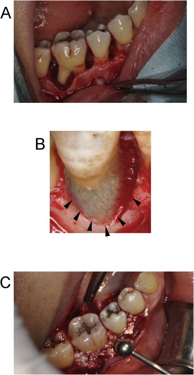 Fig. 2