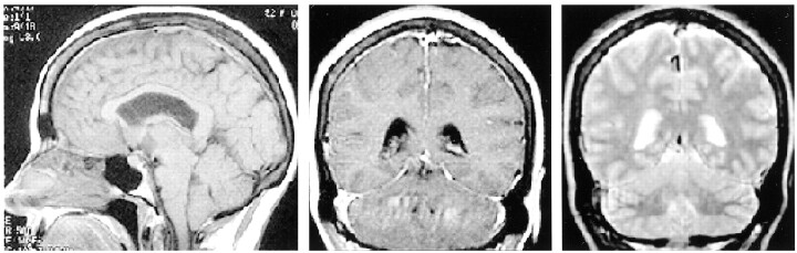 Fig 2.