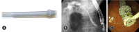 Fig. 2.