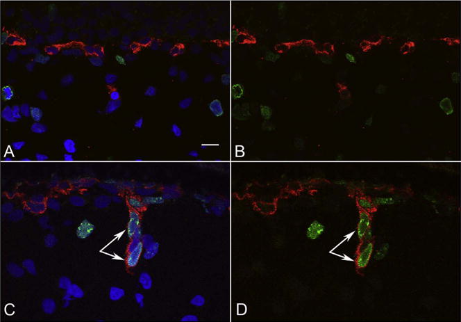 Fig. 12