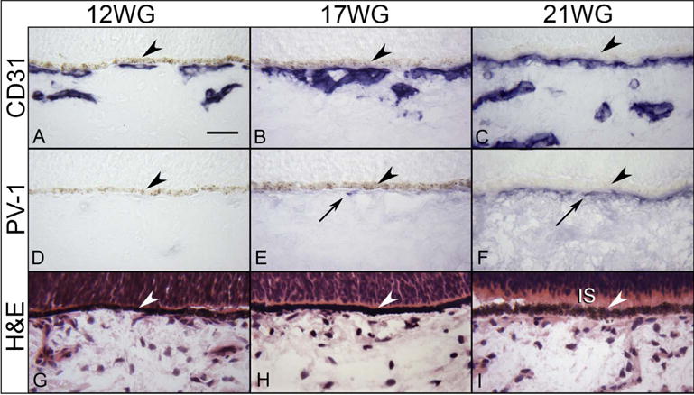 Fig. 16