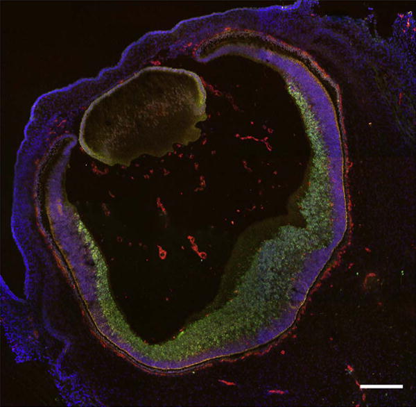 Fig. 18