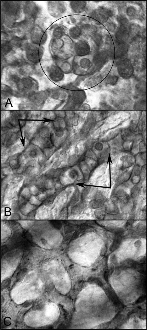 Fig. 13