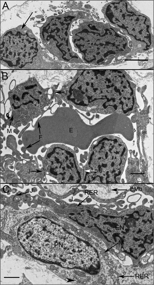 Fig. 14