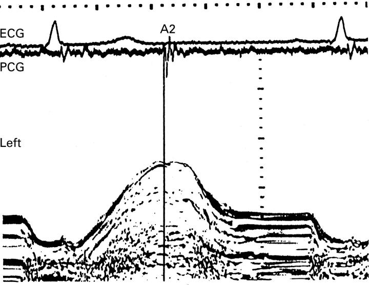 Figure 2  