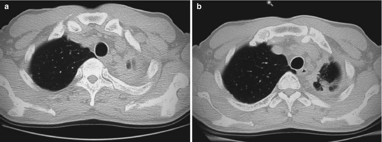 Fig. 17.115