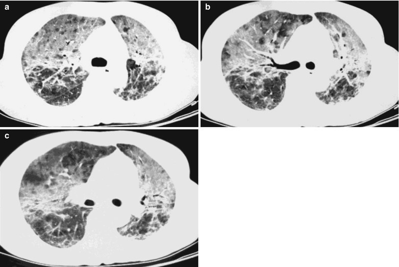 Fig. 17.16