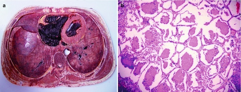 Fig. 17.45