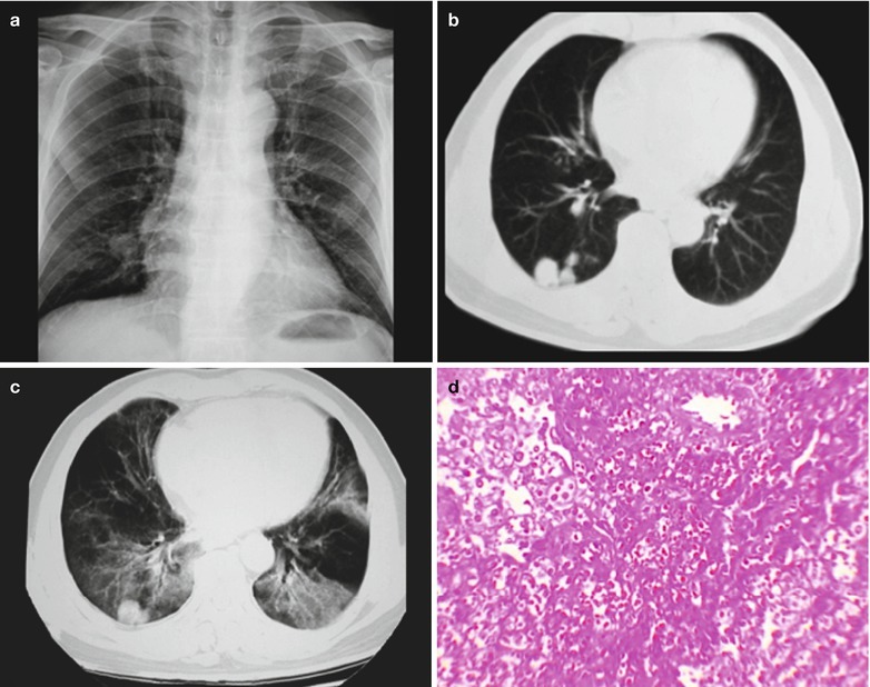 Fig. 17.96