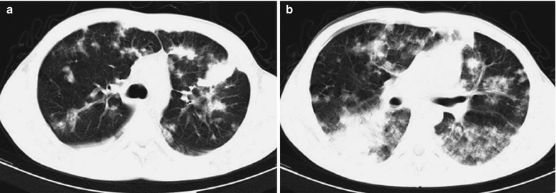 Fig. 17.114