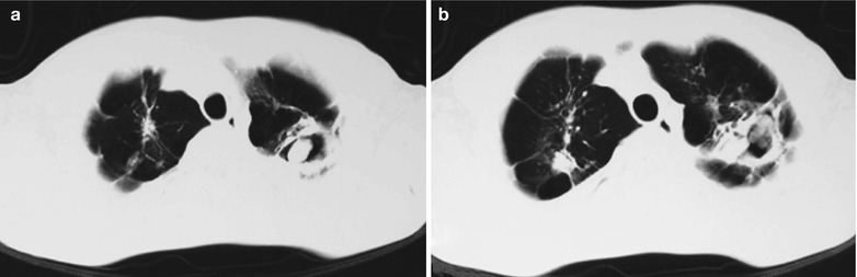 Fig. 17.75