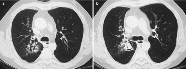 Fig. 17.69