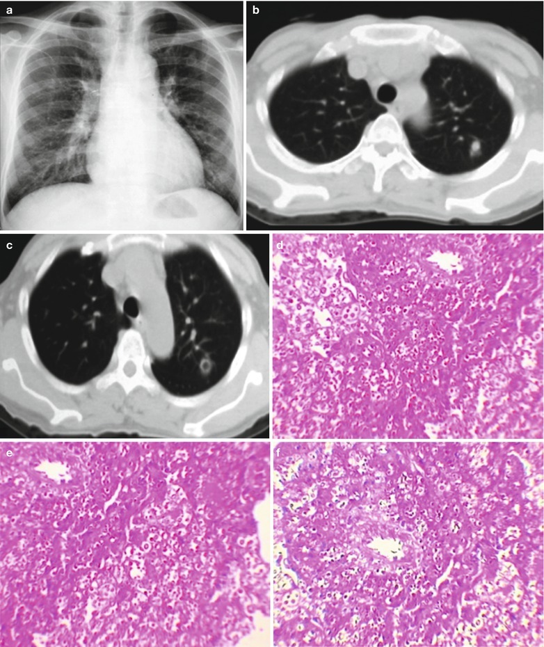 Fig. 17.81