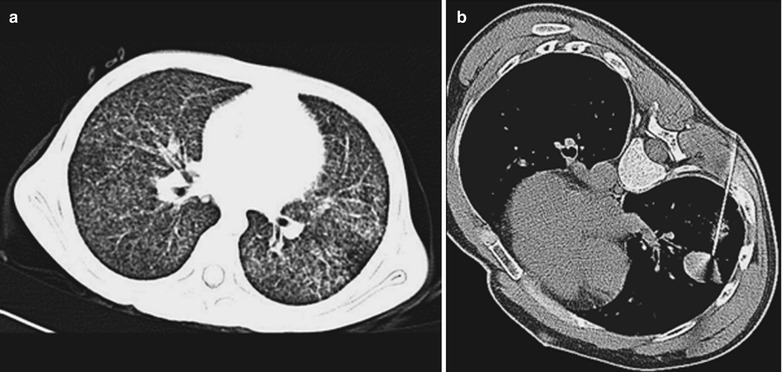 Fig. 17.28