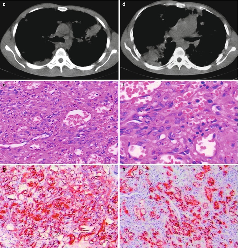 Fig. 17.114