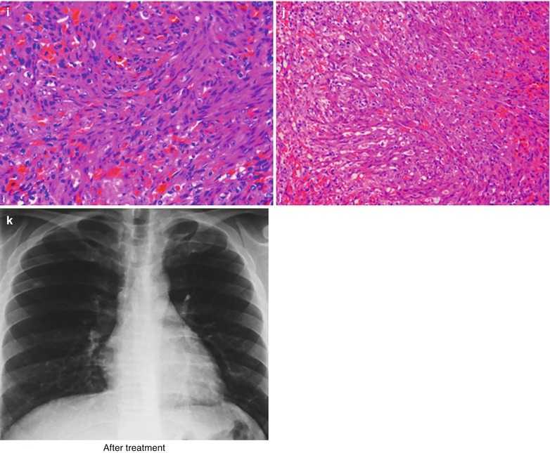 Fig. 17.110