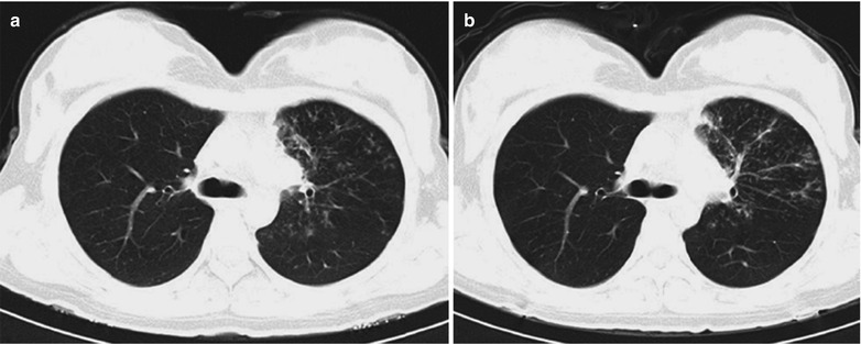 Fig. 17.40