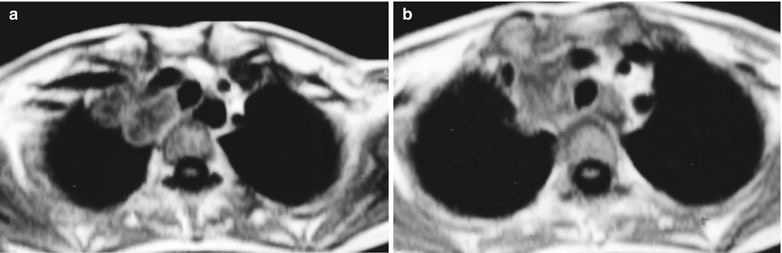 Fig. 17.25